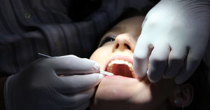 Was freiliegende Zahnhälse über Dich und Dein Leben verraten
